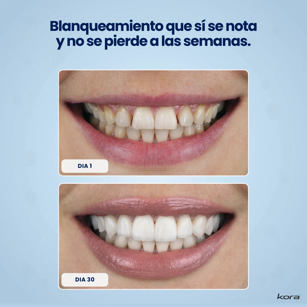 Combo Blanqueador Premium Kora®